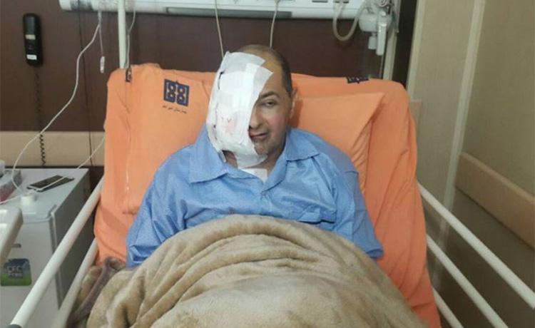 ifmat - Journalist Loses Eye and Part of His Face, Untreated While in Prison